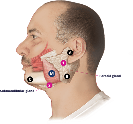 Diagram showing the where to inject XEOMIN®.