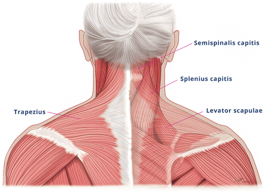 Possible muscles involved in cervical dystonia.